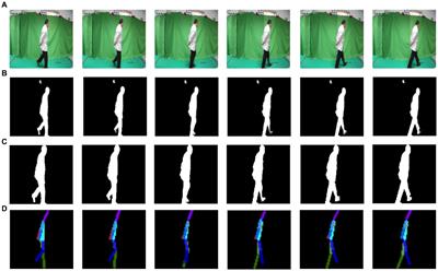 Machine vision-based gait scan method for identifying cognitive impairment in older adults